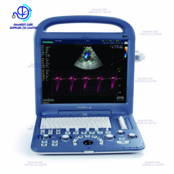 Vet Portable Ultrasound Scanner, Animal Veterinary Portable Color Doppler Ultrasound  Machine Sonoscape S2V | Hamnest Care Supplies (U) Ltd